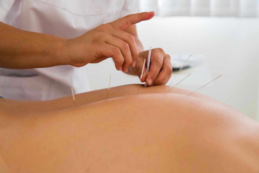 Иглоукалывание в санатории Крепость в городе Кисловодске - фотография